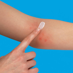 La Roche-Posay Lipikar Eczema Med Cr 30 Ml